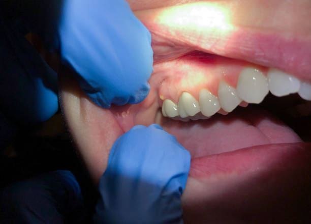 Best Emergency Broken Tooth Repair in Eagle River, WI