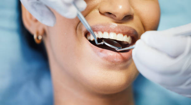Best Emergency Tooth Extraction in Eagle River, WI